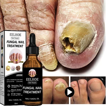 Сыворотка для лечения грибковых ногтей, масло для восстановления ног, эссенция для удаления грибка ногтей на ногах, крем против инфекции, красота, здоровье, новый 30 мл